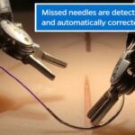 da Vinci Surgical System, il robot chirurgico che raggiunge la precisione umana nelle suture